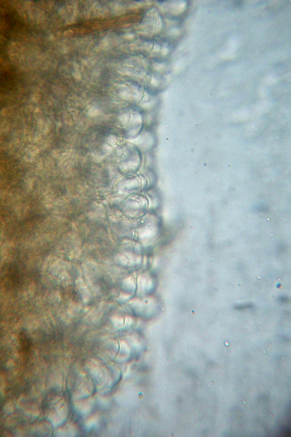 Due tentativi (miseri) di microscopia